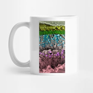 Retina of the eye, SEM (C026/4532) Mug